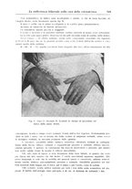 giornale/CFI0363168/1941/unico/00000381