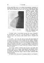 giornale/CFI0363237/1932/unico/00000072