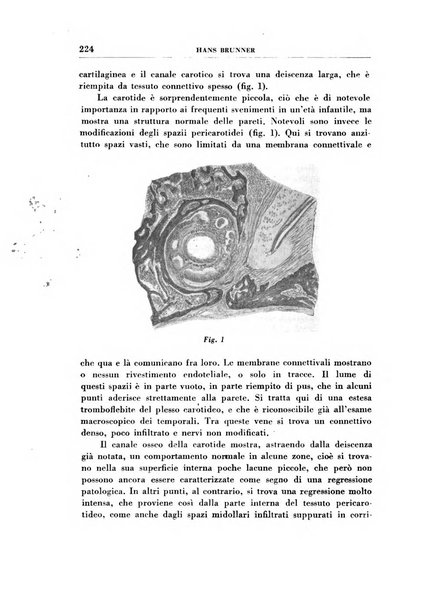 Rassegna italiana di oto-rino-laringologia