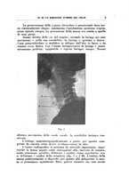 giornale/CFI0363237/1933/unico/00000011