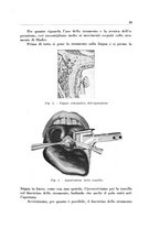 giornale/CFI0363237/1935/unico/00000099