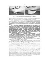giornale/CFI0364270/1935/v.2/00000170