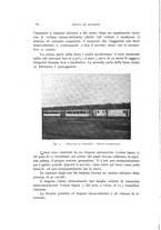 giornale/CFI0364369/1913/unico/00000086