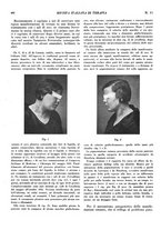 giornale/CFI0364730/1933/unico/00000464