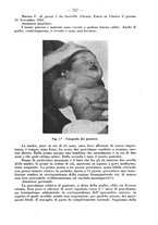 giornale/CFI0393646/1935/unico/00000819