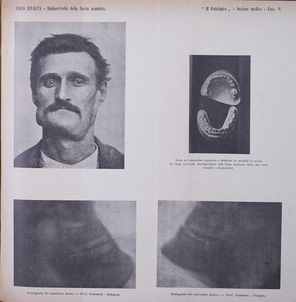 Il policlinico. Sezione medica