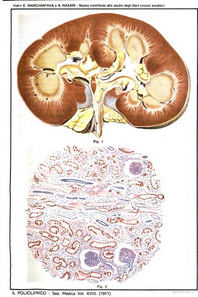 Il policlinico. Sezione medica