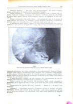 giornale/CFI0397627/1914/unico/00000521