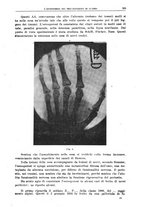 giornale/CFI0397627/1918/unico/00000269