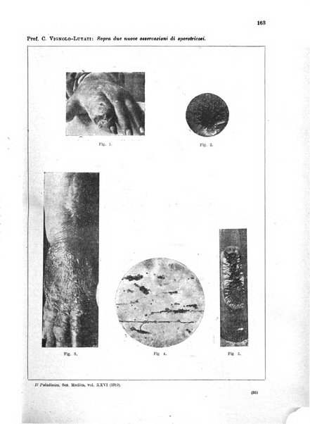 Il policlinico. Sezione medica