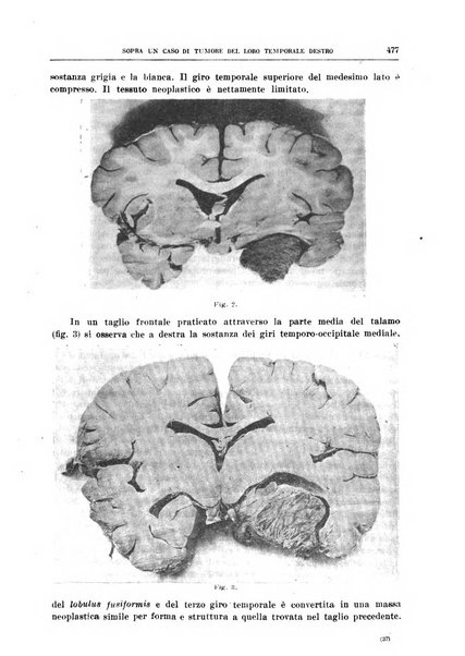 Il policlinico. Sezione medica