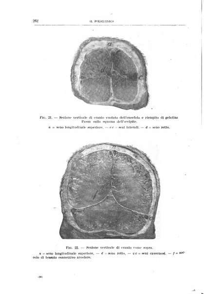 Il policlinico. Sezione medica