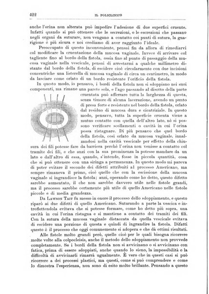 Il policlinico. Sezione chirurgica organo della Società italiana di chirurgia