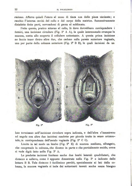 Il policlinico. Sezione chirurgica organo della Società italiana di chirurgia