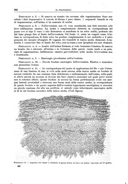 Il policlinico. Sezione chirurgica organo della Società italiana di chirurgia