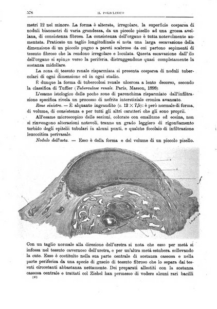 Il policlinico. Sezione chirurgica organo della Società italiana di chirurgia