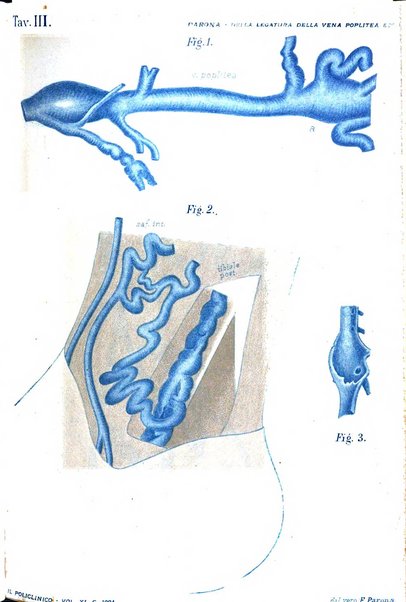 Il policlinico. Sezione chirurgica organo della Società italiana di chirurgia