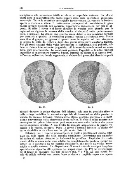 Il policlinico. Sezione chirurgica organo della Società italiana di chirurgia