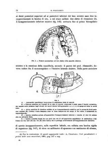 Il policlinico. Sezione chirurgica organo della Società italiana di chirurgia