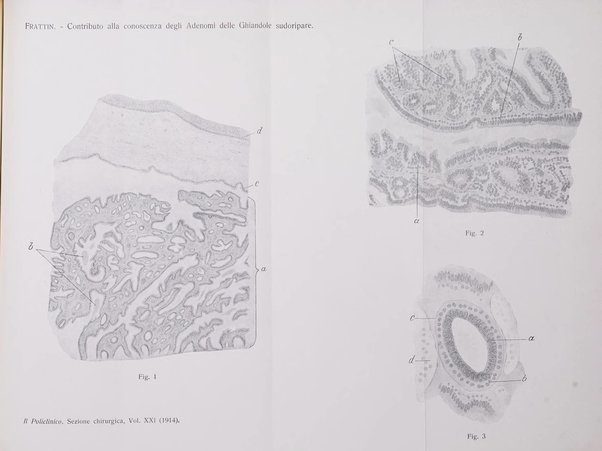 Il policlinico. Sezione chirurgica organo della Società italiana di chirurgia