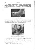 giornale/CFI0397638/1917/unico/00000190