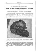 giornale/CFI0397638/1917/unico/00000202