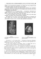 giornale/CFI0397638/1917/unico/00000241