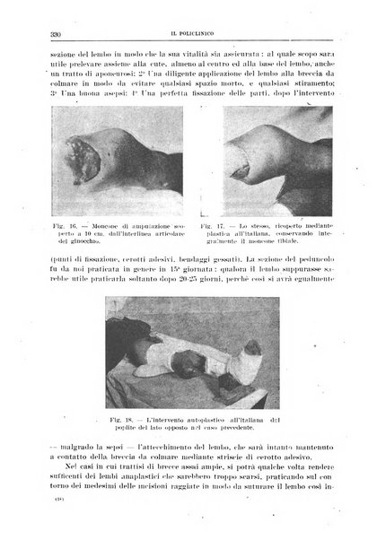 Il policlinico. Sezione chirurgica organo della Società italiana di chirurgia