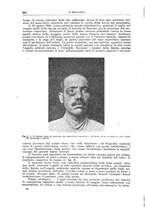 giornale/CFI0397638/1917/unico/00000414