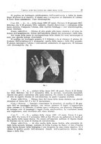 giornale/CFI0397638/1918/unico/00000085