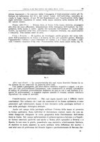 giornale/CFI0397638/1918/unico/00000087