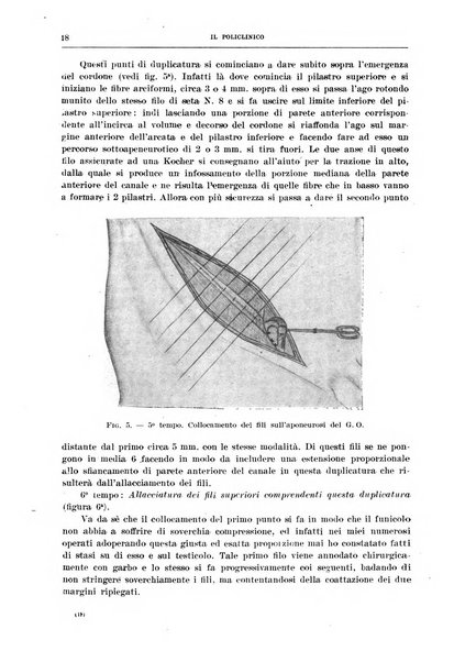 Il policlinico. Sezione chirurgica organo della Società italiana di chirurgia