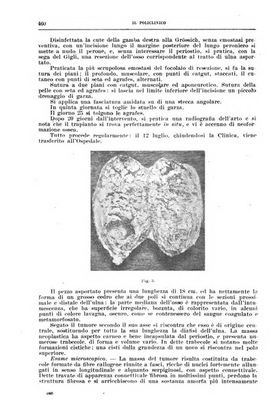 Il policlinico. Sezione chirurgica organo della Società italiana di chirurgia