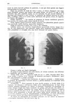 giornale/CFI0397638/1924/unico/00000610