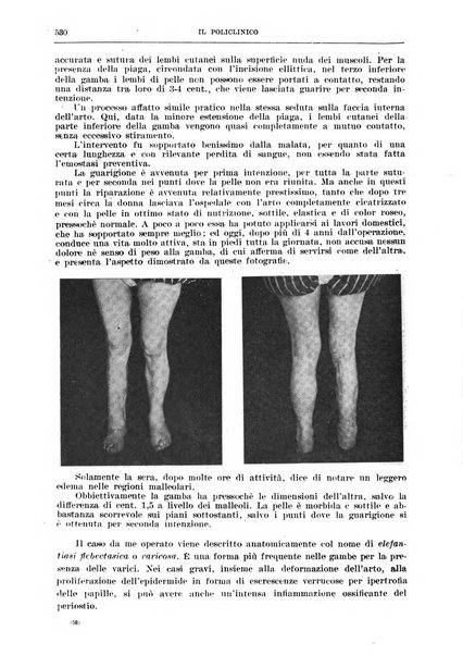 Il policlinico. Sezione chirurgica organo della Società italiana di chirurgia