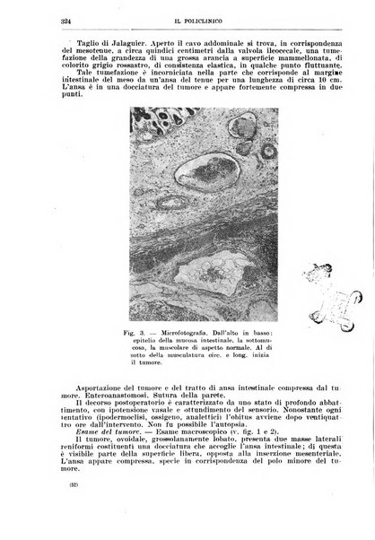 Il policlinico. Sezione chirurgica organo della Società italiana di chirurgia