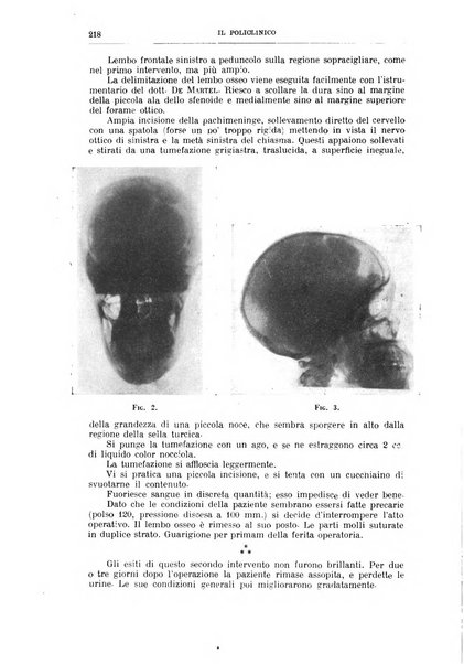 Il policlinico. Sezione chirurgica organo della Società italiana di chirurgia