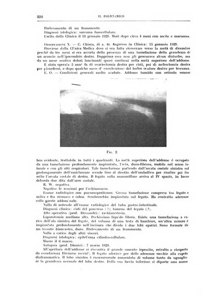 Il policlinico. Sezione chirurgica organo della Società italiana di chirurgia