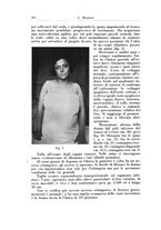 giornale/CFI0440930/1929/v.2/00000386