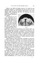 giornale/CFI0440930/1929/v.2/00000387