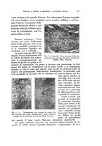 giornale/CFI0440930/1929/v.2/00000435