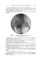 giornale/CFI0440930/1933/unico/00000201