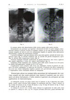 giornale/CFI0442859/1935/unico/00000042