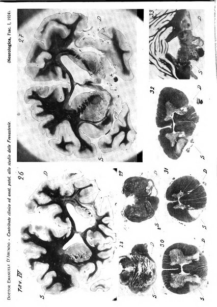 Neurologica rivista italiana di neuropatologia e psichiatria