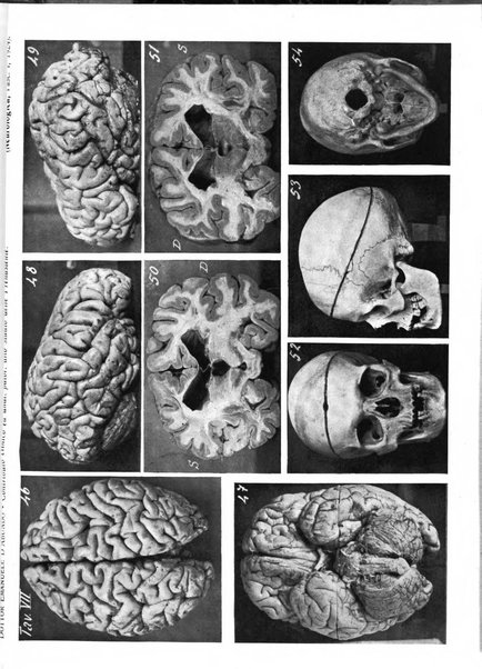 Neurologica rivista italiana di neuropatologia e psichiatria