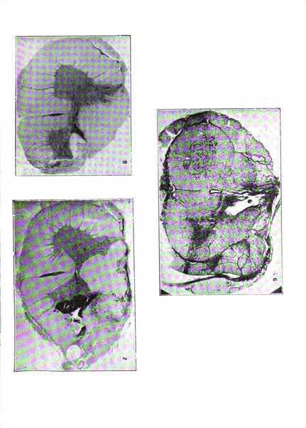 Neurologica rivista italiana di neuropatologia e psichiatria