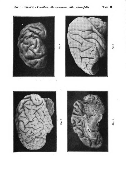 Neurologica rivista italiana di neuropatologia e psichiatria