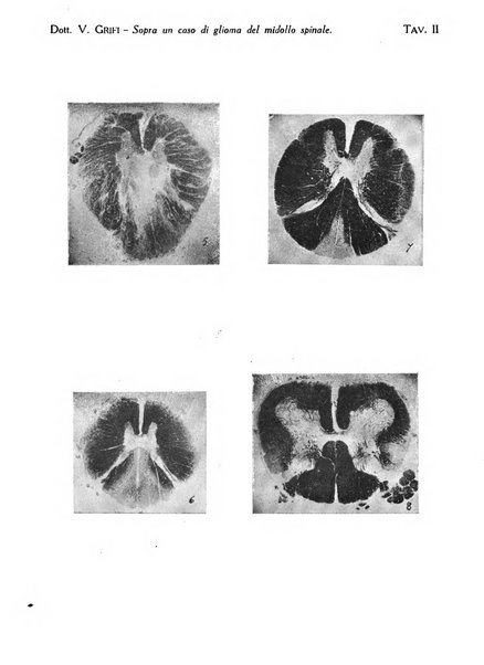 Neurologica rivista italiana di neuropatologia e psichiatria