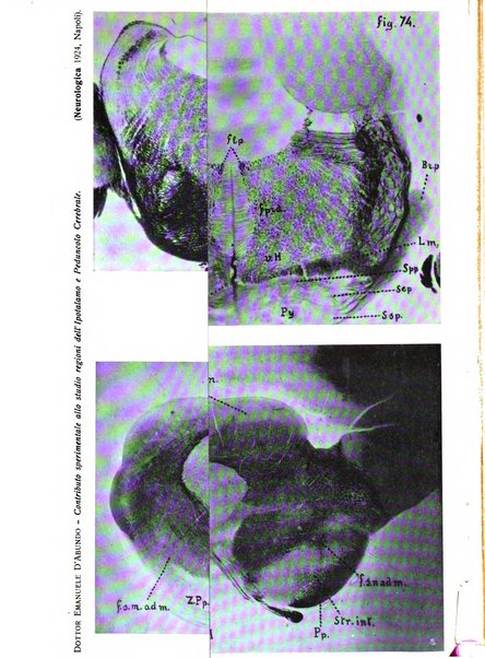 Neurologica rivista italiana di neuropatologia e psichiatria