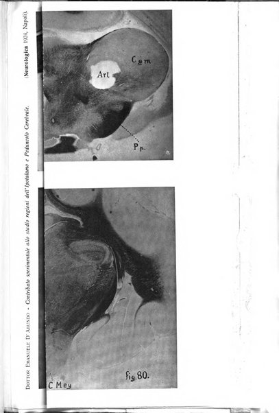 Neurologica rivista italiana di neuropatologia e psichiatria